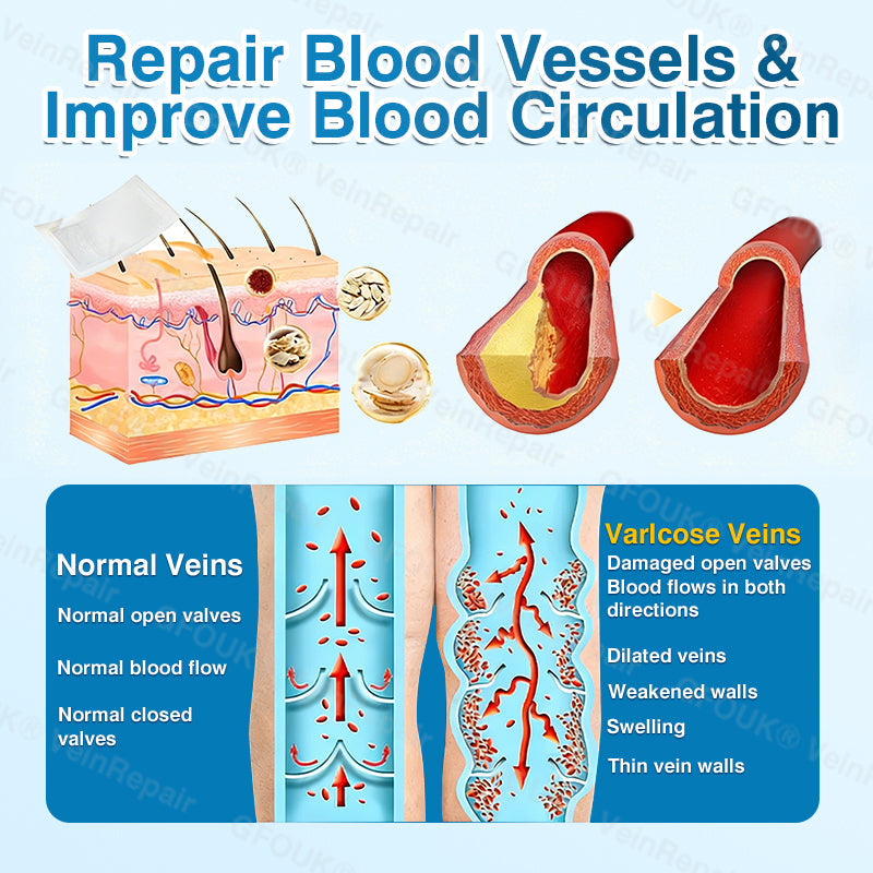 🇬🇧👨‍⚕️👨‍⚕️✅GFOUK® VeinRepair Microneedle Patch Roll⚡Instant Relief, Long-Term Results