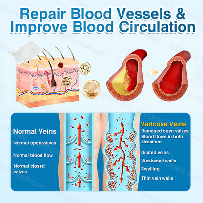 🇬🇧👨‍⚕️👨‍⚕️✅GFOUK® VeinRepair Microneedle Patch Roll⚡Instant Relief, Long-Term Results