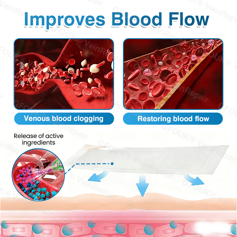 🇬🇧🏆✅️🏃GFOUK® VeinRepair Microneedle Patch Roll⚡Instant Relief, Long-Term Results