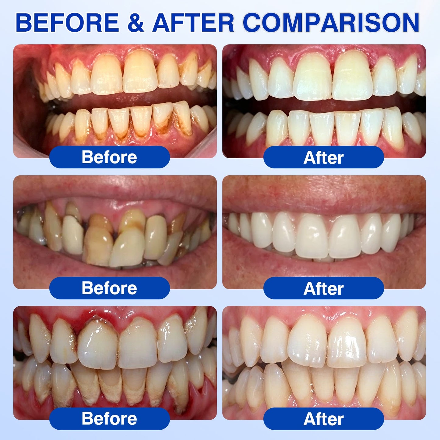 🇬🇧👨‍⚕️✅😁Evolvion® GumRevive Periodontal Repair Gel