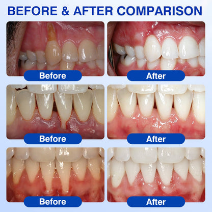 🇬🇧👨‍⚕️✅😁Evolvion® GumRevive Periodontal Repair Gel