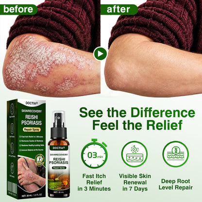 🇬🇧🎁DOCTIA® SkinRecovery Reishi Psoriasis Repair Spray