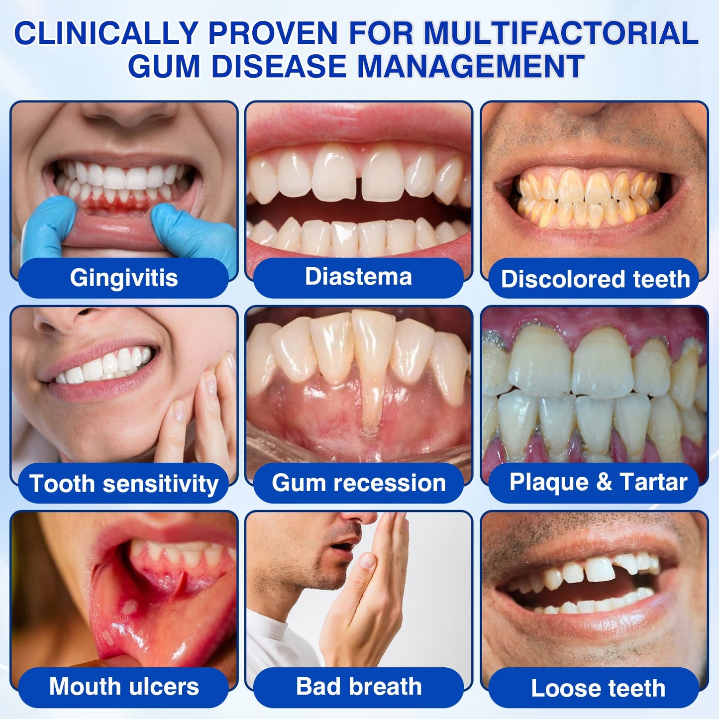 🇬🇧👨‍⚕️✅😁Evolvion® GumRevive Periodontal Repair Gel