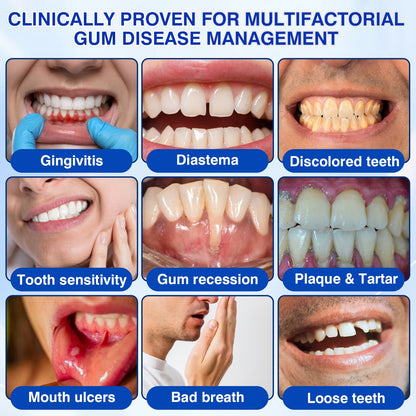 🇬🇧👨‍⚕️✅😁Evolvion® GumRevive Periodontal Repair Gel