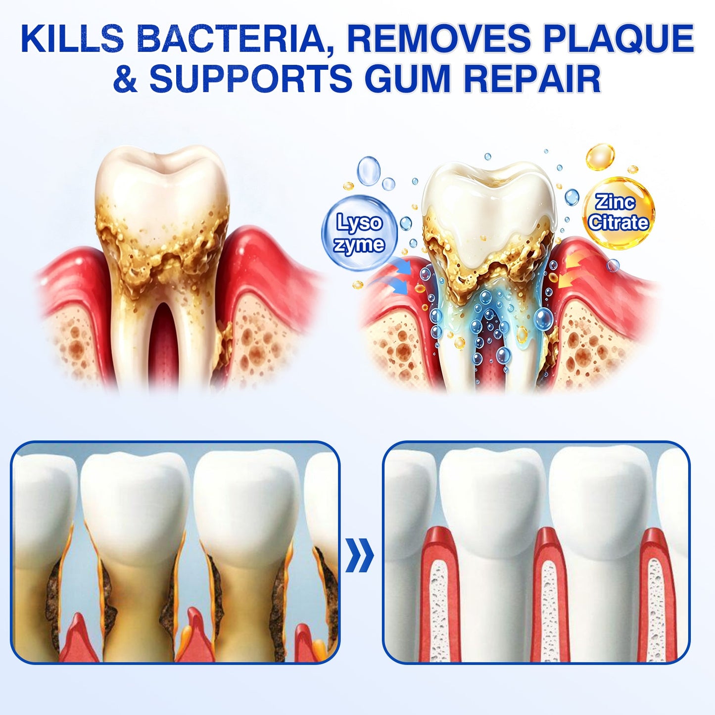 🇬🇧👨‍⚕️✅😁Evolvion® GumRevive Periodontal Repair Gel