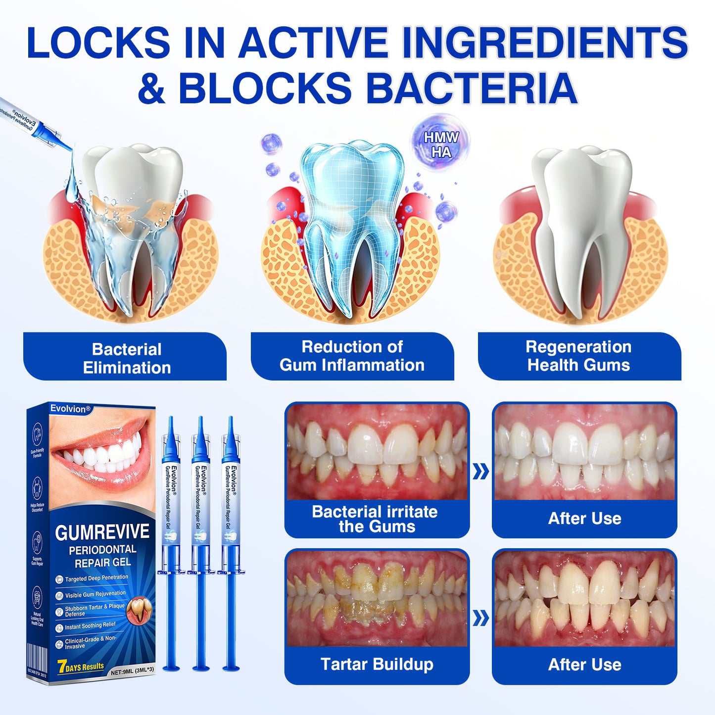 🇬🇧👨‍⚕️🦷✨Evolvion® GumRevive Periodontal Repair Gel