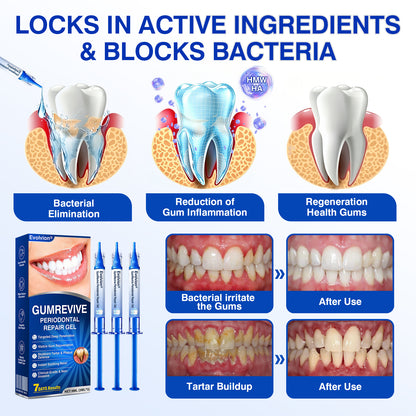 🇬🇧👨‍⚕️🦷✨Evolvion® GumRevive Periodontal Repair Gel
