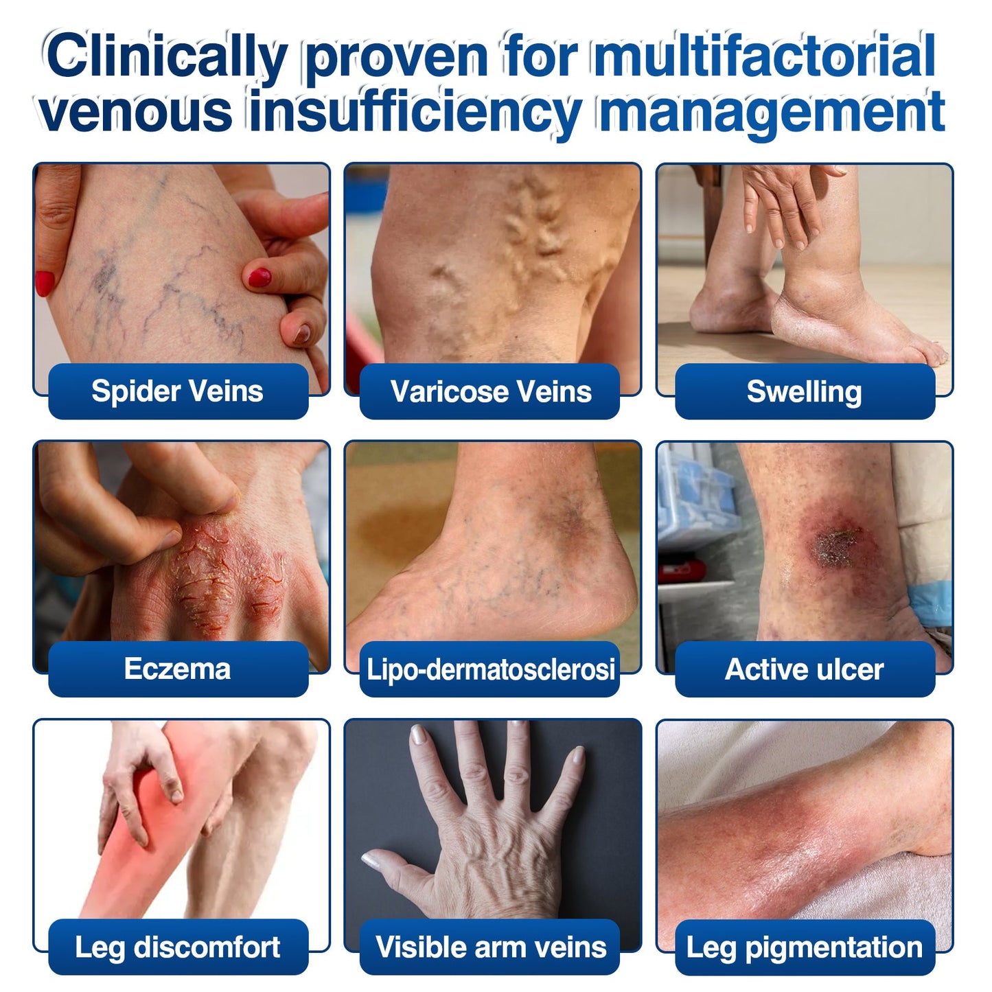 uk👨‍⚕️🦵🛡️GFOUK® VeinRenew Microneedle Balm
