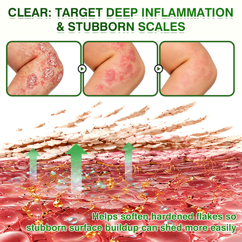 🇬🇧🎁DOCTIA® SkinRecovery Reishi Psoriasis Repair Spray