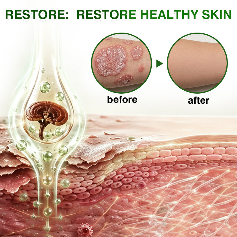 🇬🇧🎁DOCTIA® SkinRecovery Reishi Psoriasis Repair Spray