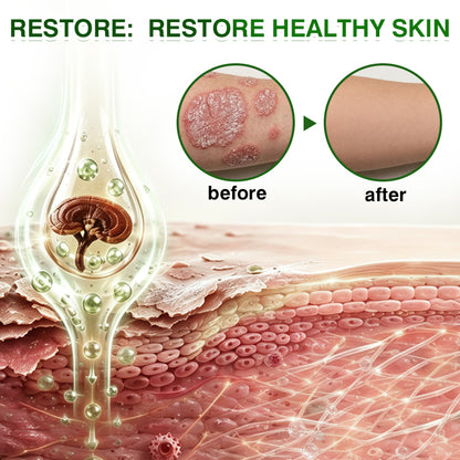 🇬🇧🎁DOCTIA® SkinRecovery Reishi Psoriasis Repair Spray