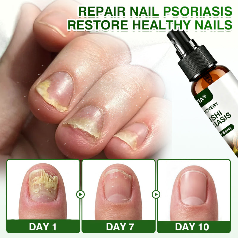 🇬🇧🎁DOCTIA® SkinRecovery Reishi Psoriasis Repair Spray