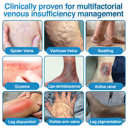 🇬🇧👨‍⚕️👨‍⚕️✅GFOUK® VeinRepair Microneedle Patch Roll⚡Instant Relief, Long-Term Results