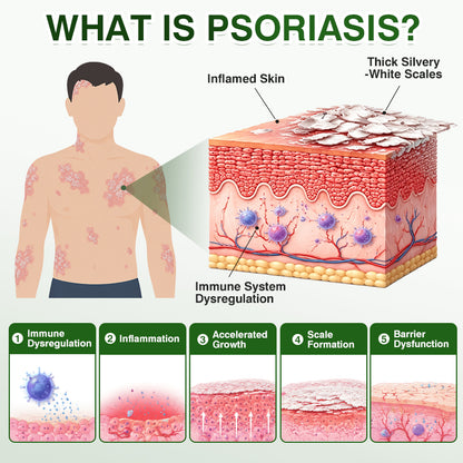 🇬🇧🎁DOCTIA® SkinRecovery Reishi Psoriasis Repair Spray