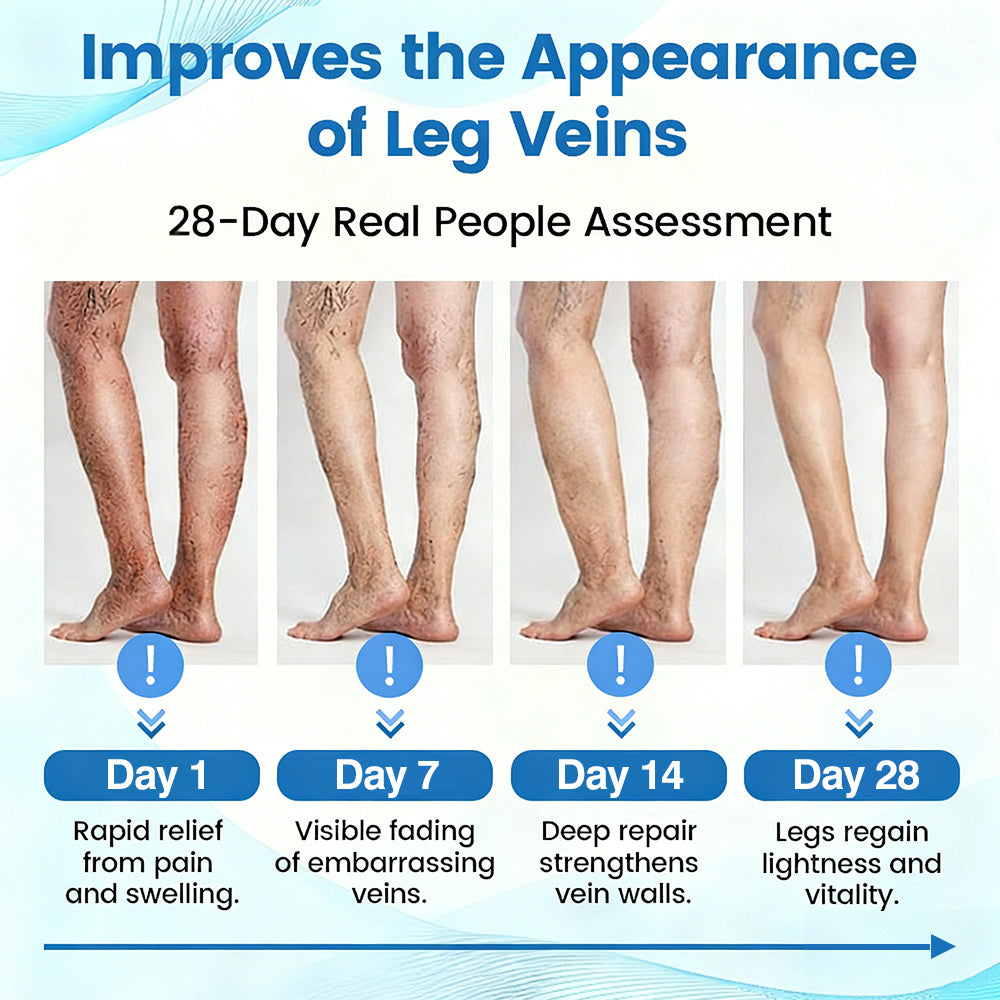 🇬🇧👨‍⚕️👍GFOUK® VascuCare Vein Healing Spray(Designed for Varicose veins, Spider veins, Deep vein Thrombosis, Chronic venous insufficiency, Venous ulcers, Thrombophlebitis and other venous issues)