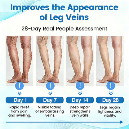 🇬🇧👨‍⚕️👍GFOUK® VascuCare Vein Healing Spray(Designed for Varicose veins, Spider veins, Deep vein Thrombosis, Chronic venous insufficiency, Venous ulcers, Thrombophlebitis and other venous issues)